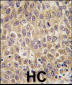 AFP Antibody (N-term)